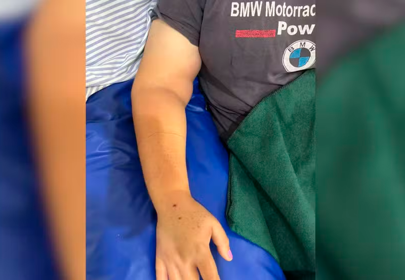 Mulher é picada por cobra jararaca enquanto colhia abóboras em sítio no interior de SP